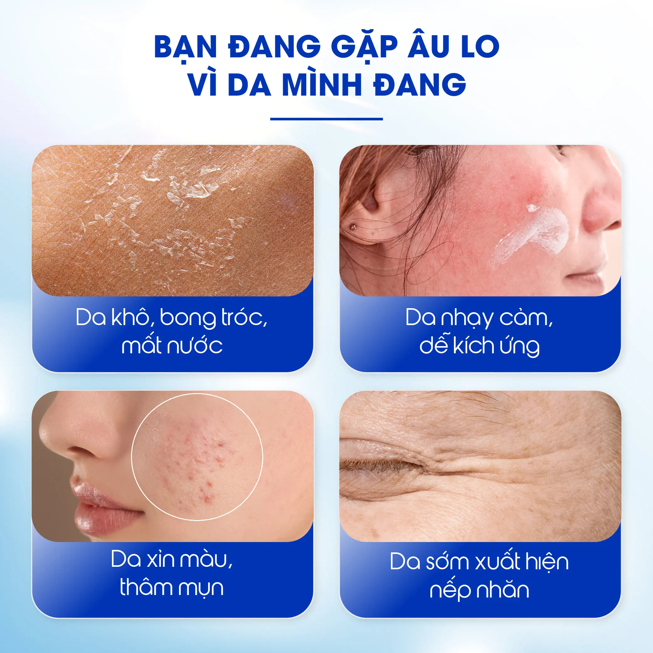 tinh chat phuc hoi da sieu cap am carenel hyaluvita b5 cica serum 30 ml 01 1