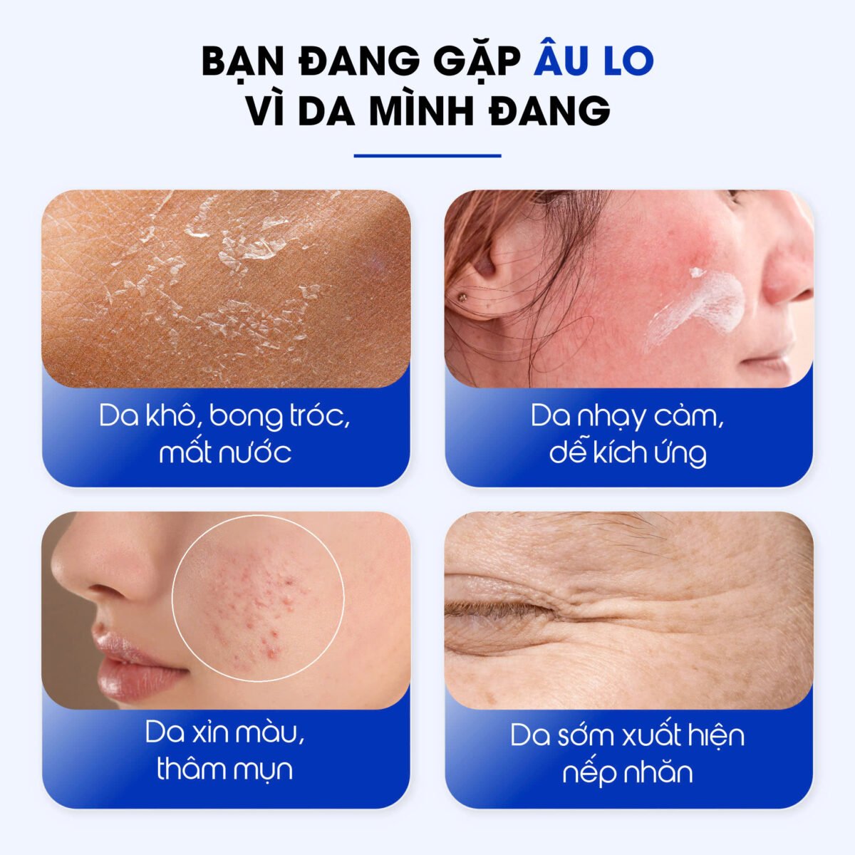 Tinh chất phục hồi da siêu cấp ẩm Care:nel Hyaluvita B5 Cica Serum 30ml - Ảnh 3