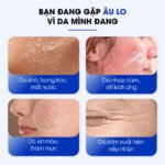 Tinh chất phục hồi da siêu cấp ẩm Care:nel Hyaluvita B5 Cica Serum 30ml - Ảnh 3