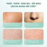 Kem dưỡng ẩm mờ nám cải thiện sắc tố da Care:nel Anti-Melesma Centella Cream 40ml - Ảnh 3