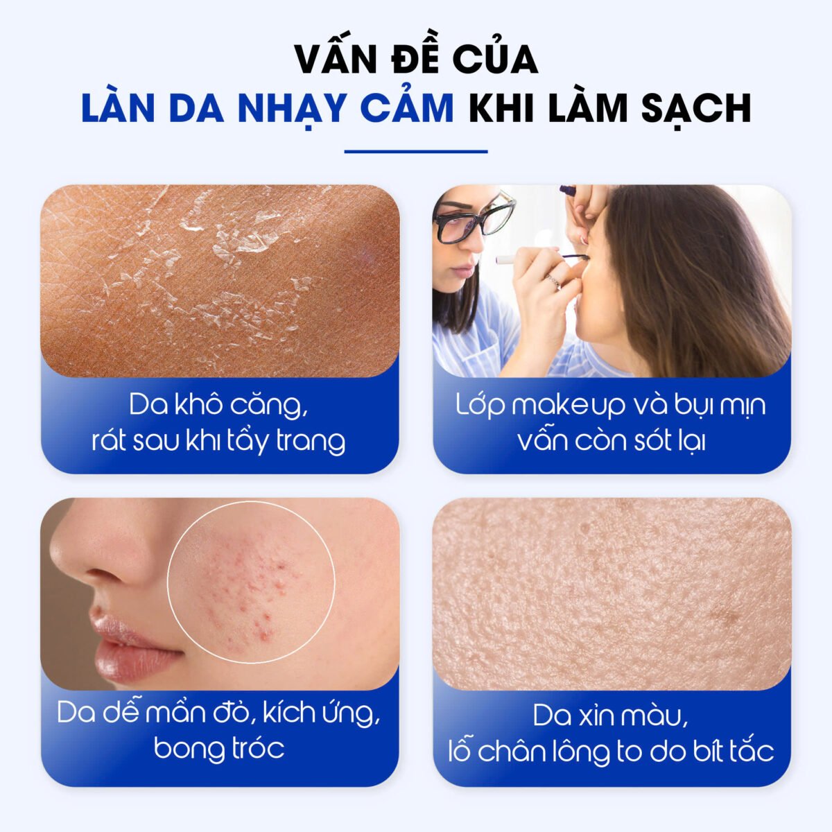 Nước tẩy trang làm dịu tẩy sạch và phục hồi cho da nhạy cảm Carenel Cicavita B5 AHA BHA Cleansing Water 500g - Ảnh 3