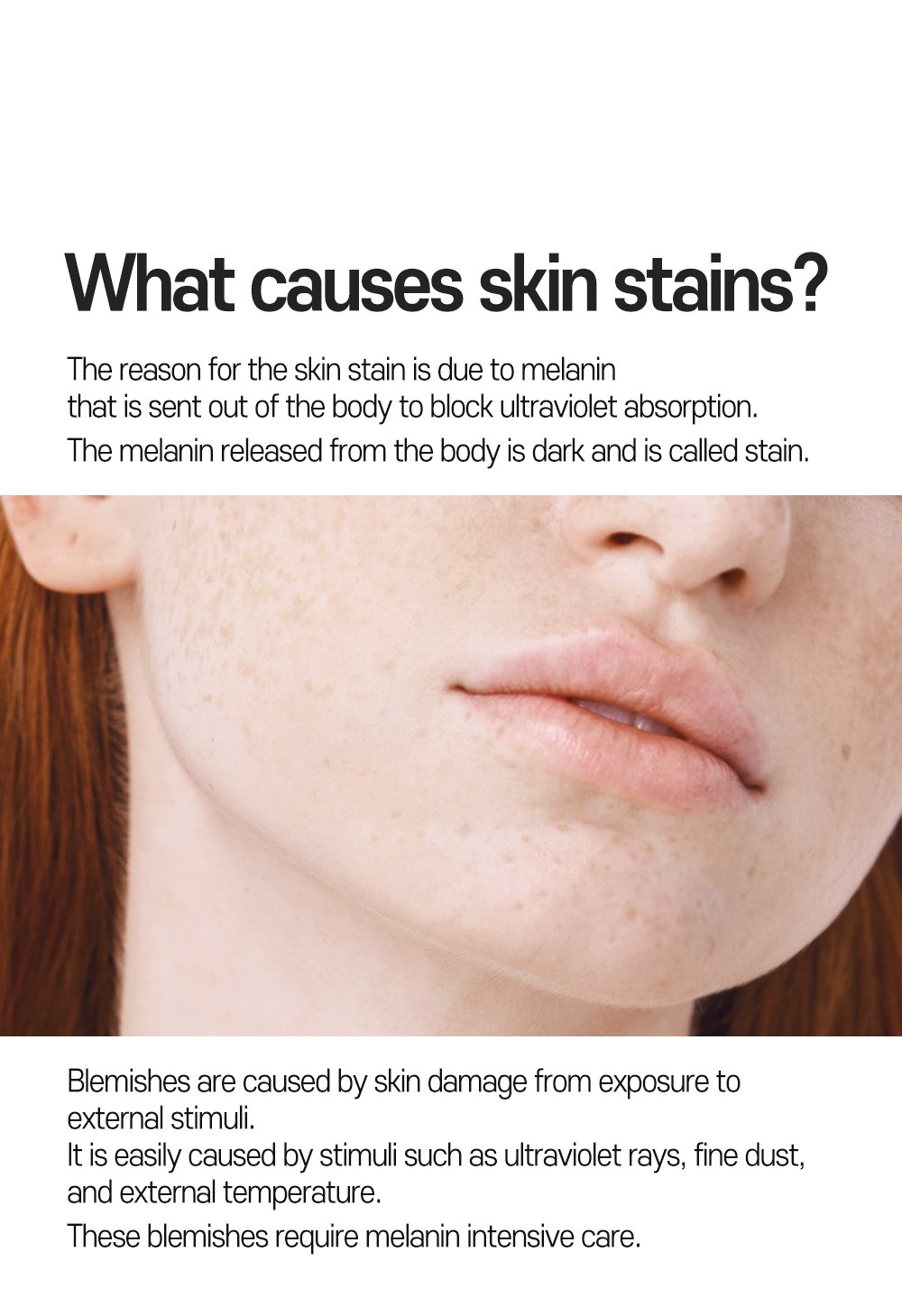 Anti melasma cica cream detail en 06