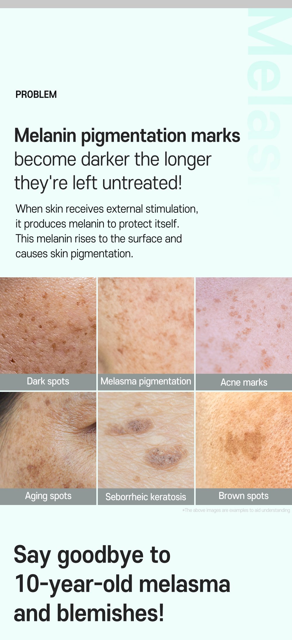 3.Anti melasma Cica Intensive Serum Detail En