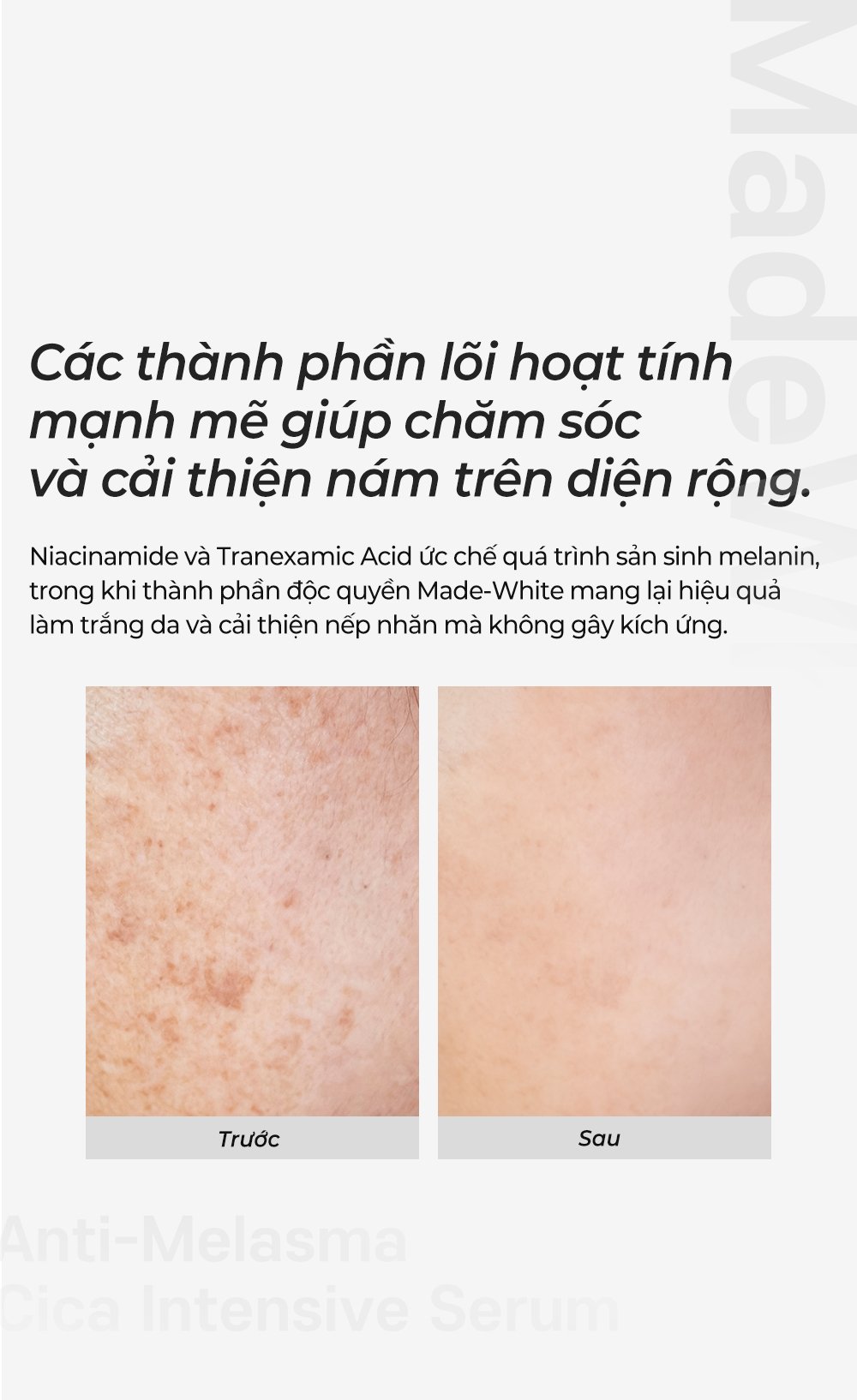 4 Anti melasma Cica Intensive Serum Detail En