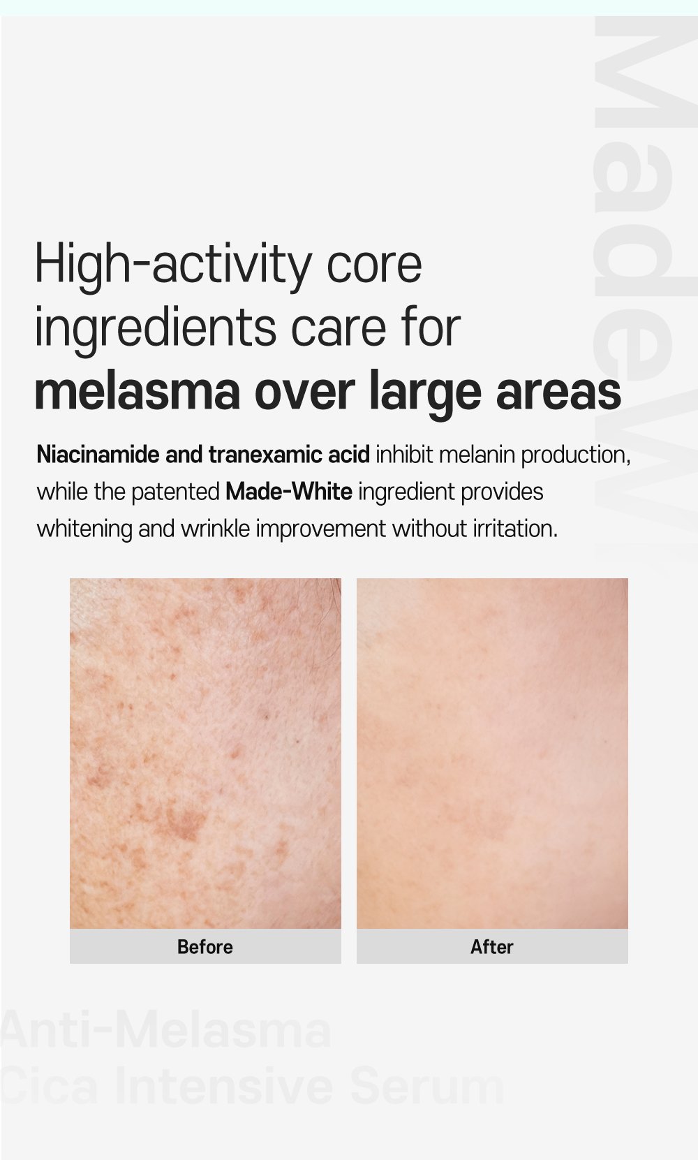 4. Anti melasma Cica Intensive Serum Detail En