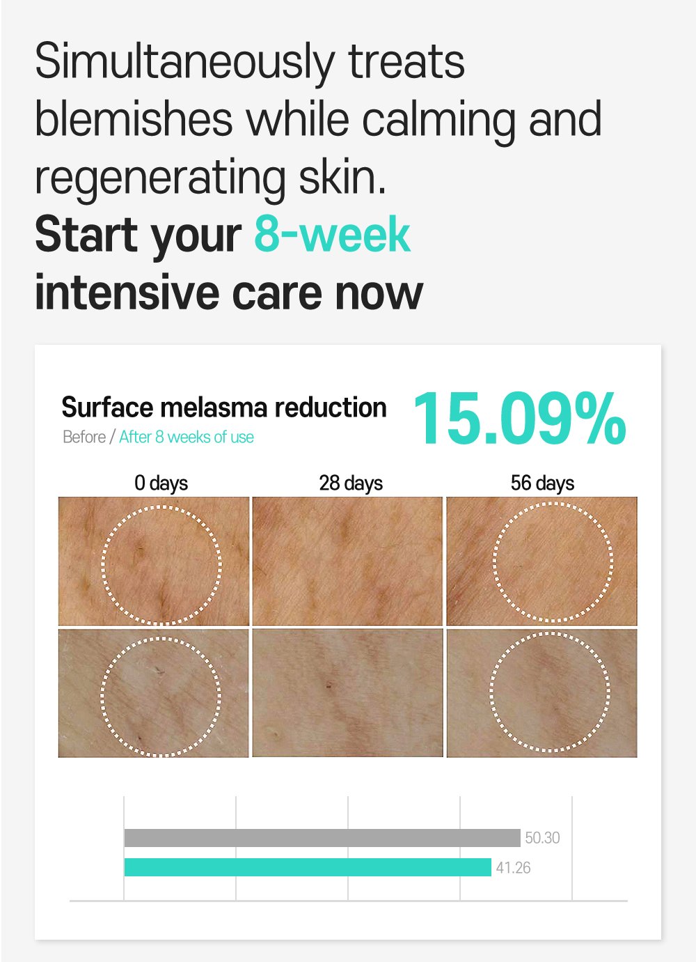 5.Anti melasma Cica Intensive Serum Detail En