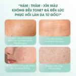 Tinh chất mờ thâm nám, dưỡng sáng da Carenel Anti-melasma Cica Intensive Serum 30ml - Ảnh 3