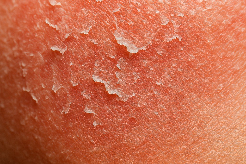tinh chat phuc hoi da sieu cap am carenel hyaluvita b5 cica serum 1