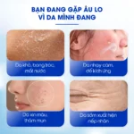 Tinh chất phục hồi da siêu cấp ẩm Carenel Hyaluvita B5 Cica Serum 110ml - Ảnh 3