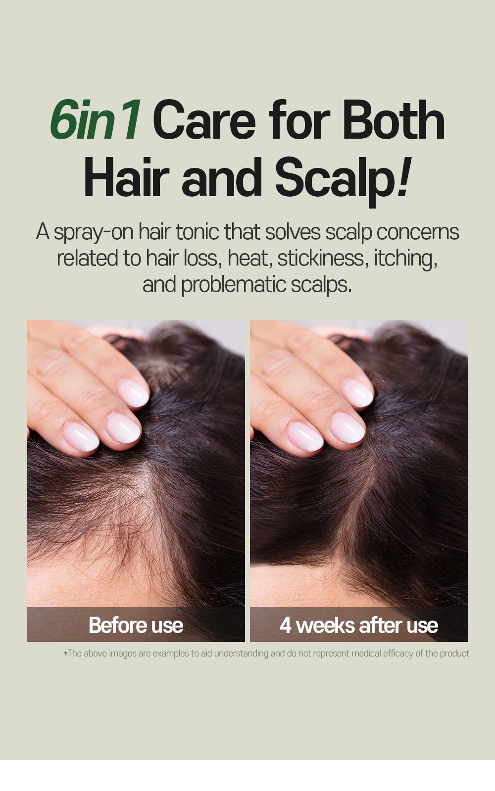 anti hair loss scalp tonic Detail 10 1
