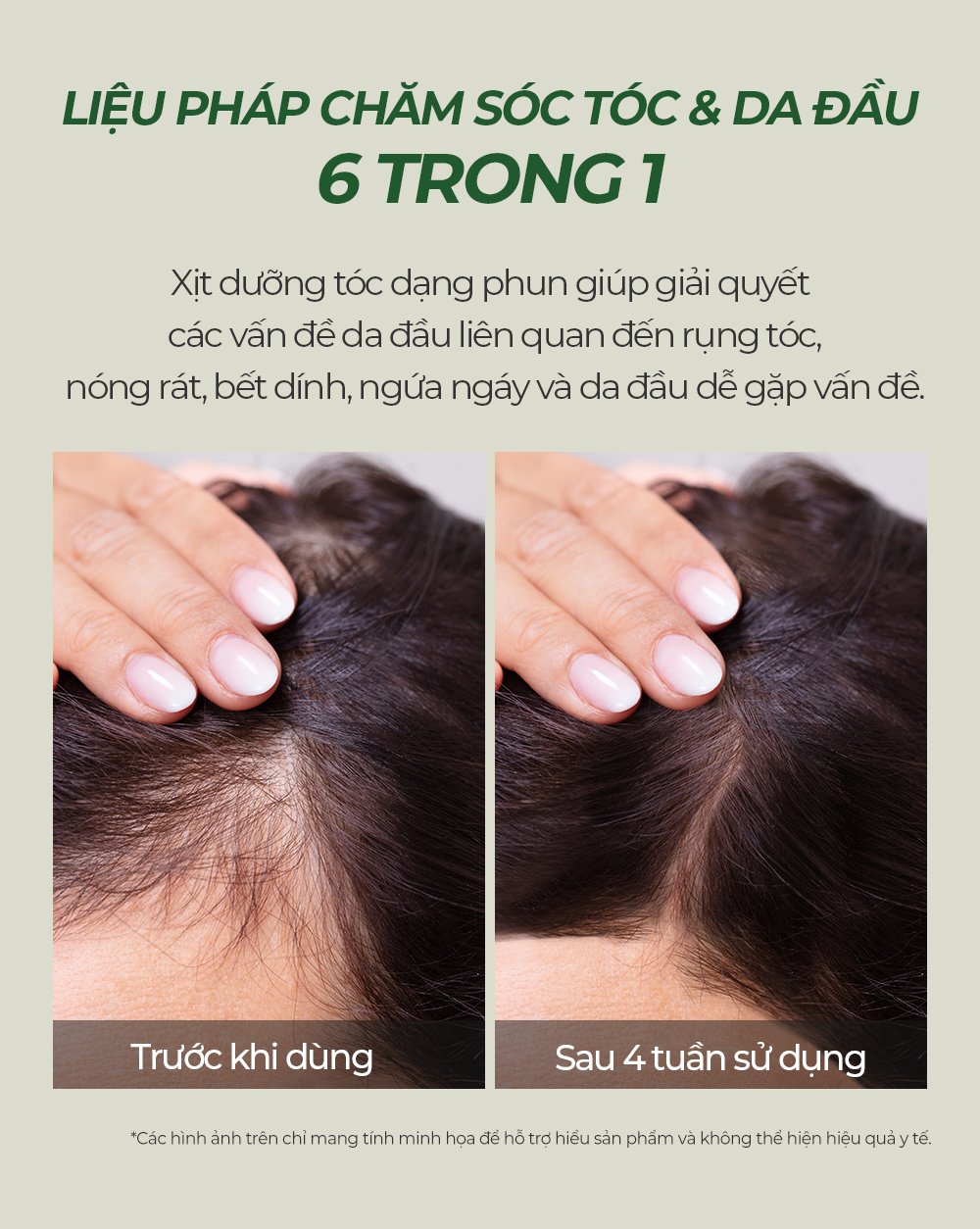 anti hair loss scalp tonic Detail 11